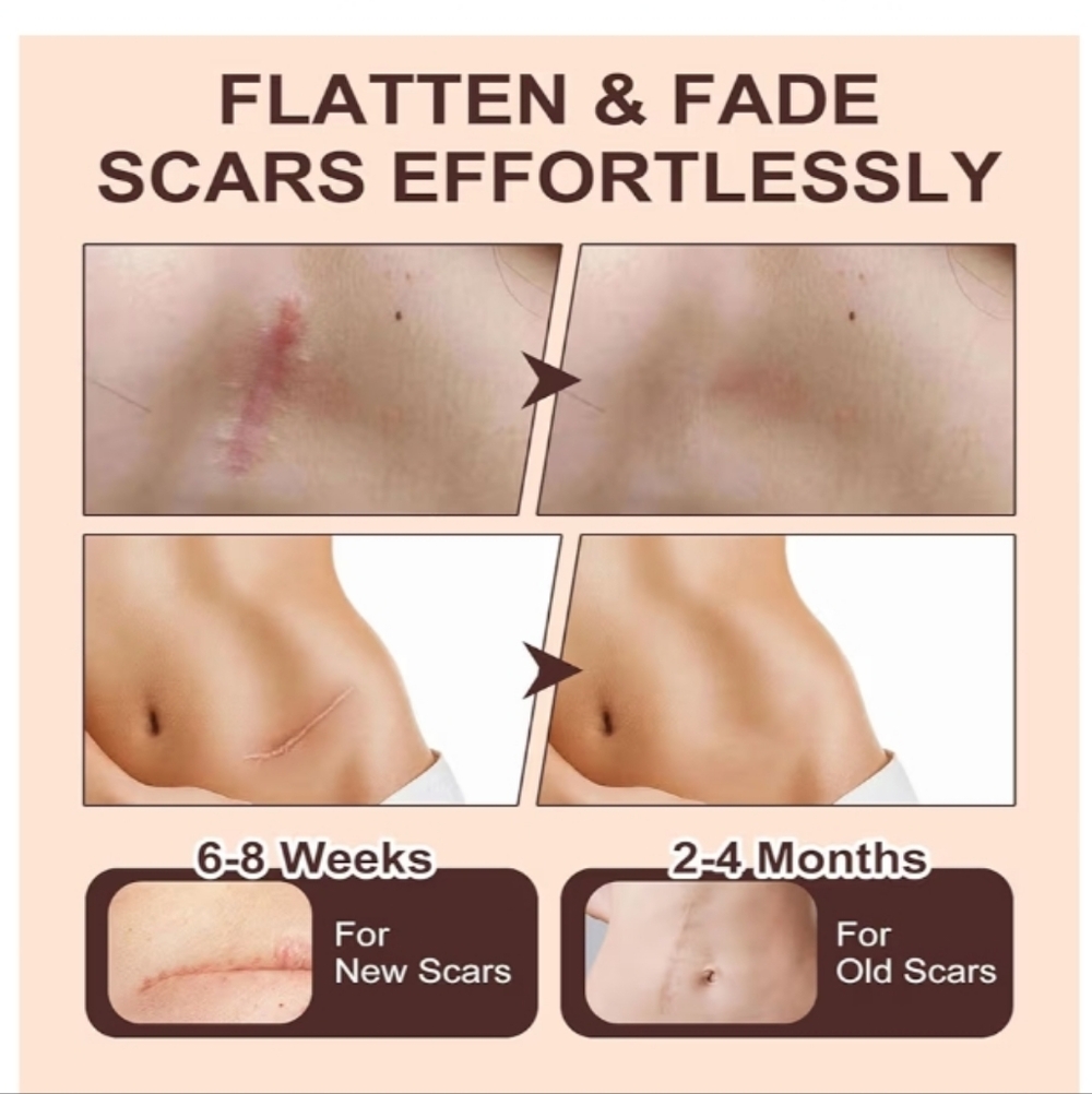 Silicone‎ Scar Stick, Silicone Scar Solutions for Face and Body, with Centell - Picture 4 of 12